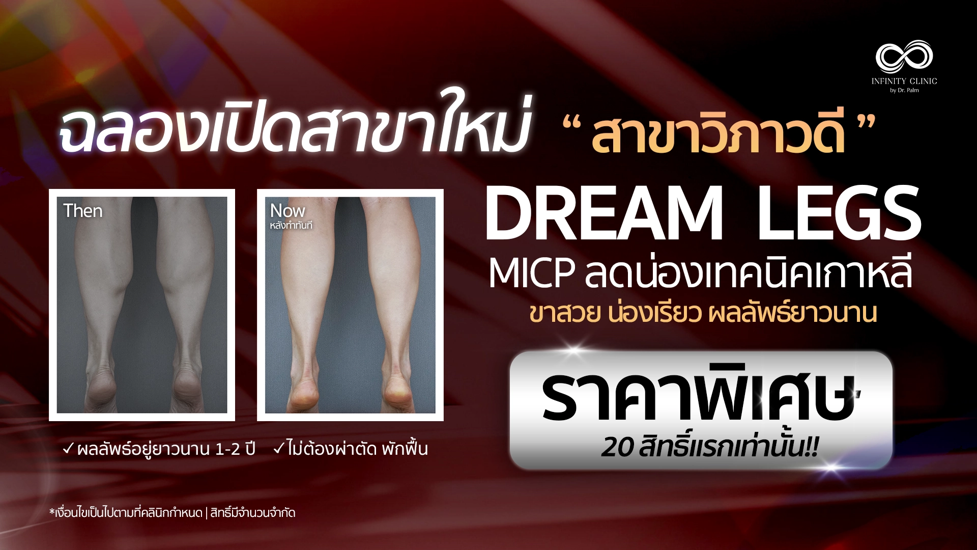 ลดน่องใหญ่ สาขาวิภาวดี