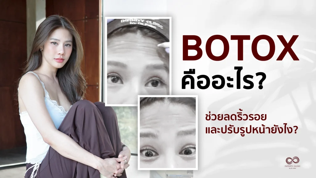 Botox