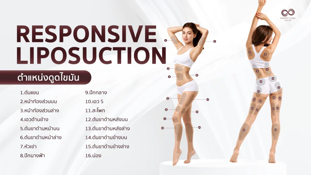 ตำแหน่งดูดไขมัน